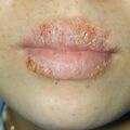 misuse_vacrax011009.jpg