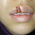 misuse_vacrax011015.jpg