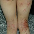 misuse_vaseline020223-1.jpg