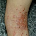misuse_vaseline020223-2.jpg