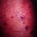 misuse_verrumal9-162.jpg