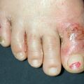 misuse_vinegar010530-1.jpg