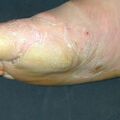 misuse_vinegar010530-2.jpg
