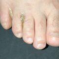 misuse_vinegar010605-1.jpg
