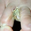 misuse_vinegar010605-2.jpg