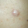 misuse_vinegar010605.jpg