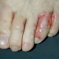 misuse_vinegar011210-1.jpg
