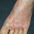misuse_vinegarjung010614-1.jpg