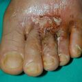 misuse_vinegarjung020806.jpg