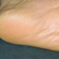misuse_vinegarjung020828-2.jpg