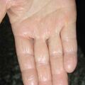 misuse_virnosil020820-3.jpg