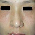 misuse_vision010411.jpg