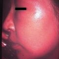 misuse_vision2000-219.jpg