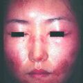 misuse_vision2000-393.jpg