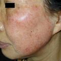 misuse_vison010530-1.jpg