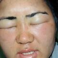 misuse_vison020403.jpg