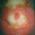 misuse_vitiligo8-611.jpg