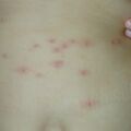 misuse_westcort020807-2.jpg