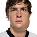 mumps.jpg