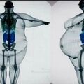 obesity.jpg