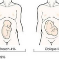 oblique_lie_2635.png