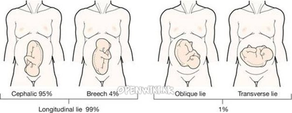 oblique_lie_2635.png