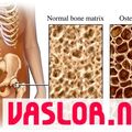 osteoporosis.jpg