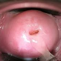 ovulation_4045.png