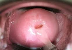ovulation_4045.png