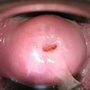 ovulation_4045.png