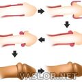 penis_augmentation.jpg