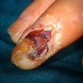 periarteritis7-1.jpg