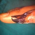 periarteritis7-31.jpg