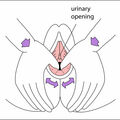 perineal_massage.jpg