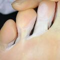 pitted010214.jpg