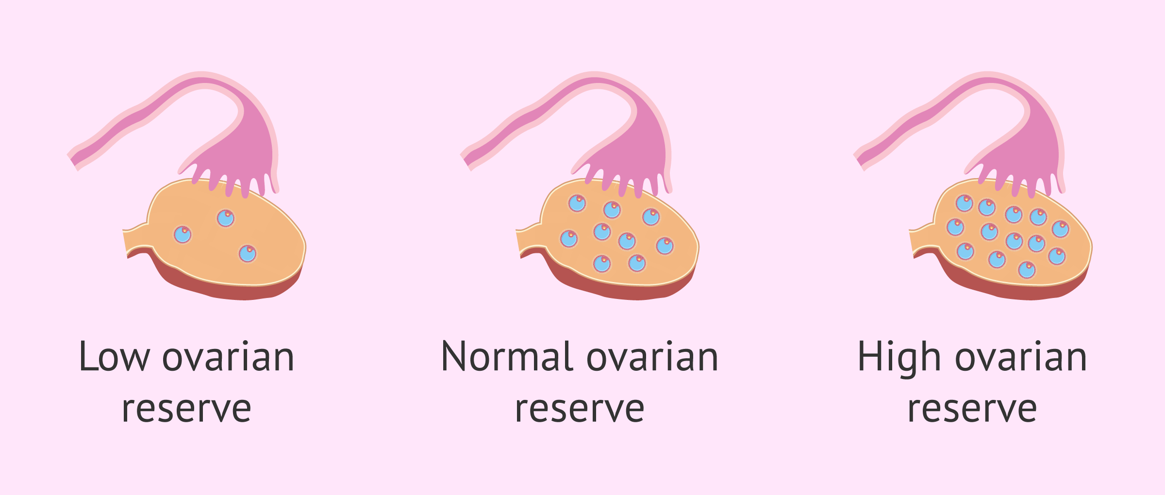 poor_ovarian_reserve.png