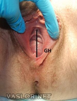 popq-gh.jpg
