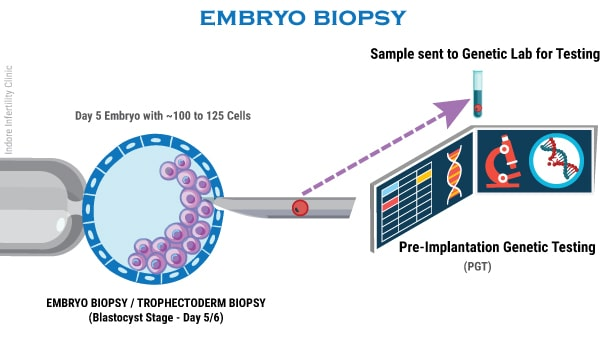 preimplantation_genetic_diagnosis_2321.png