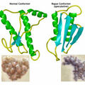 prion.jpg