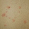 prosea010217-2.jpg
