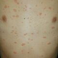 prosea010217-3.jpg