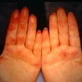 raynaud9-253.jpg