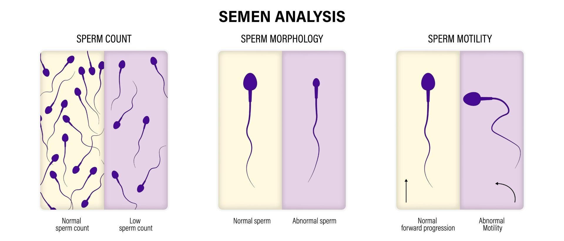 semen_analysis.jpg
