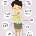 sjogren_syndrome_1120.png