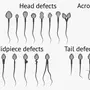 sperm_morphology.webp