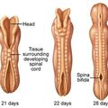 spina_bifida-neural_tube_caudal_neuropore.jpg