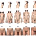 tanner_stages.jpg