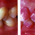 teeth_1017022703.png