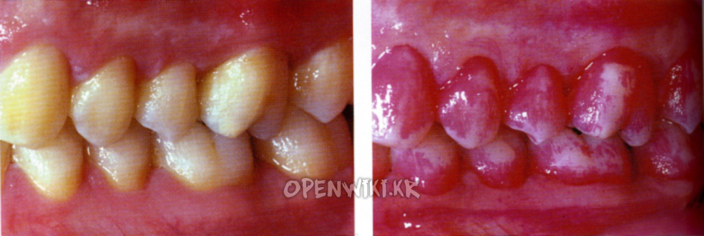 teeth_1017022703.png