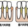 teeth_1017023346.png